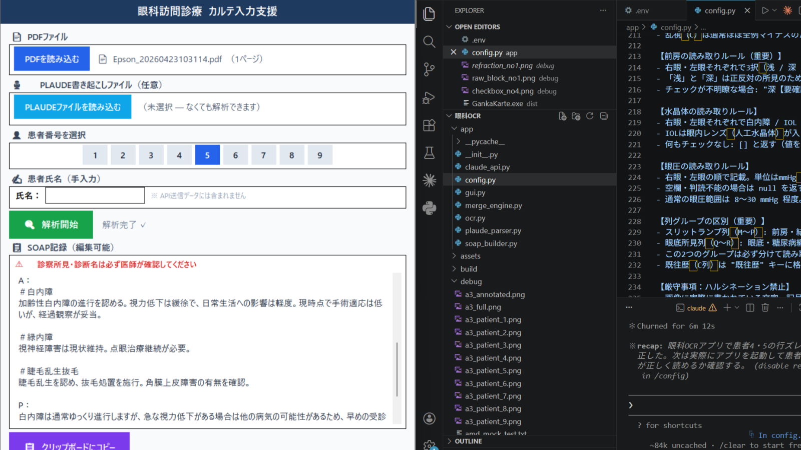 眼科診療 OCR / SOAP補助